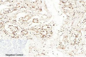 Immunohistochemical analysis of paraffin-embedded human breast tissue. (Caspase 7 抗体  (AA 160-240))