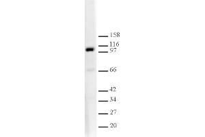 L3MBTL1 antibody tested by Western blot. (L3MBTL1 抗体  (AA 1-215))