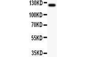 Anti-TIE2 Picoband antibody,  All lanes: Anti TIE2  at 0. (TEK 抗体  (AA 641-830))