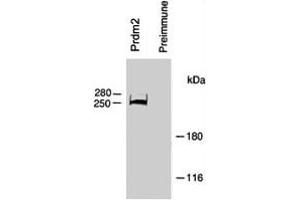 Rat B50 brain tumor cell extracts were immunoprecipitated with Prdm2 polyclonal antibody  or preimmune. (PRDM2 抗体  (AA 245-573))