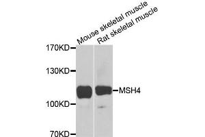 Western blot analysis of extracts of various cells, using MSH4 antibody. (MSH4 抗体)