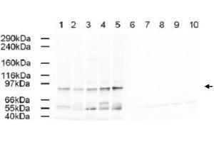Western blot using AP2A1 polyclonal antibody  shows detection of a band just below 100 KDa correspond-ing to Human AP2A1 in a various preparations. (alpha Adaptin 抗体  (AA 3-14))