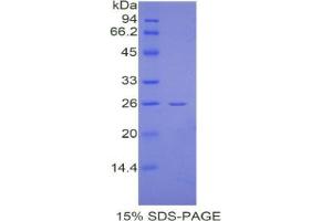 SDS-PAGE analysis of Mouse CREB Binding Protein. (CBP 蛋白)