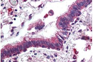 Human Lung, Respiratory Epithelium (formalin-fixed, paraffin-embedded) stained with ERBB3 antibody ABIN305733 at 5 ug/ml followed by biotinylated anti-goat IgG secondary antibody ABIN481715, alkaline phosphatase-streptavidin and chromogen. (ERBB3 抗体  (AA 1330-1342))