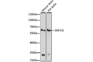 Western blot analysis of extracts of various cell lines, using ZNF331 antibody. (ZNF331 抗体)