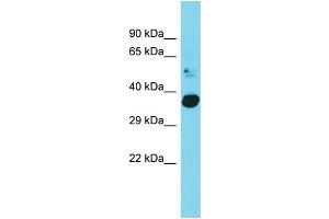 Host: Rabbit Target Name: C20orf72 Sample Type: Fetal Heart lysates Antibody Dilution: 1. (C20orf72 抗体  (C-Term))
