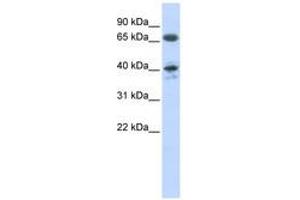 Image no. 1 for anti-Angiotensin II Receptor, Type 1 (AGTR1) (AA 37-86) antibody (ABIN6740751) (Angiotensin II Type-1 Receptor 抗体  (AA 37-86))