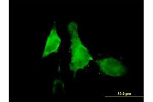 Immunofluorescence of purified MaxPab antibody to ALOX12 on HeLa cell. (ALOX12 抗体  (AA 1-663))