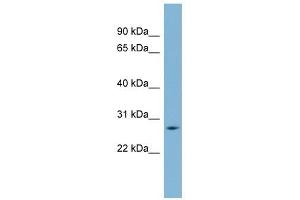GAMT antibody used at 1 ug/ml to detect target protein. (GAMT 抗体  (Middle Region))