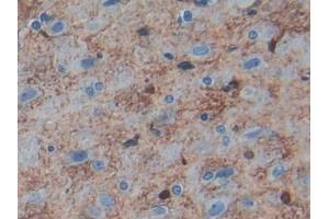 DAB staining on IHC-P; Samples: Rat Cerebrum Tissue (S100B 抗体  (AA 1-92))