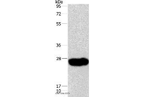 Western blot analysis of Human fetal muscle tissue, using CAV3 Polyclonal Antibody at dilution of 1:550 (Caveolin 3 抗体)