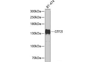 Western blot analysis of extracts of BT-474 cells using GTF2I Polyclonal Antibody at dilution of 1:500. (GTF2I 抗体)
