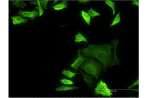 Immunofluorescence of monoclonal antibody to FLNA on HeLa cell. (Filamin A 抗体  (AA 1-838))