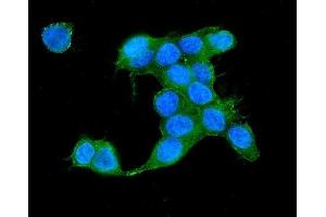 IF analysis of IQGAP2 using anti-IQGAP2 antibody (ABIN5692877). (IQGAP2 抗体  (AA 1329-1544))