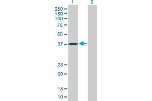 Western Blot analysis of DHRS7 expression in transfected 293T cell line by DHRS7 MaxPab polyclonal antibody. (DHRS7 抗体  (AA 1-339))