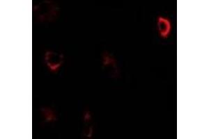 Immunofluorescent analysis of CBS staining in U2OS cells. (CBS 抗体)