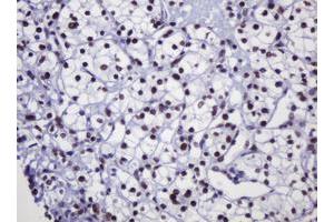 Image no. 2 for anti-Decapping Enzyme, Scavenger (DCPS) antibody (ABIN1497781) (DCPS 抗体)