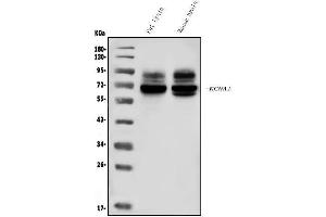 Western blot analysis of KCNA1 using anti-KCNA1 antibody (ABIN6719578).