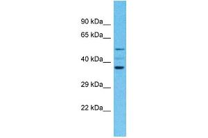 Western Blotting (WB) image for anti-Olfactory Receptor, Family 4, Subfamily F, Member 4 (OR4F4) (C-Term) antibody (ABIN2791736) (OR4F4 抗体  (C-Term))