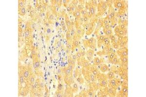 Immunohistochemistry of paraffin-embedded human liver tissue using ABIN7144419 at dilution of 1:100 (APOC3 抗体  (AA 21-99))