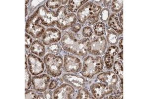 Immunohistochemical staining of human kidney with ZNF324B polyclonal antibody  shows strong cytoplasmic positivity in tubular cells at 1:50-1:200 dilution. (ZNF324B 抗体)