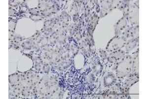 Image no. 2 for anti-Cell Division Cycle 25 Homolog C (S. Pombe) (CDC25C) (AA 21-130) antibody (ABIN598558) (CDC25C 抗体  (AA 21-130))