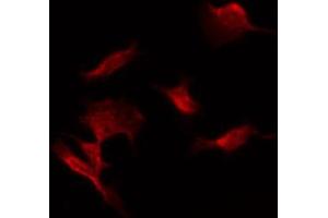 ABIN6274470 staining COLO205 by IF/ICC. (ORCTL-2/SLC22A18 抗体  (C-Term))