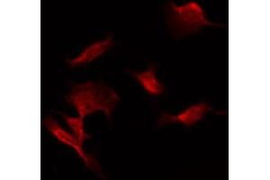 ABIN6274470 staining COLO205 by IF/ICC. (ORCTL-2/SLC22A18 抗体  (C-Term))
