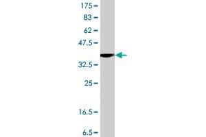 Western Blot detection against Immunogen (38. (PIKFYVE 抗体  (AA 342-451))