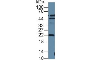 Detection of DTYMK in Human A549 cell lysate using Polyclonal Antibody to Deoxythymidylate Kinase (DTYMK) (DTYMK 抗体  (AA 43-190))