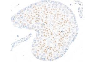 Immunohistochemistry (IHC) image for anti-Jumonji Domain Containing 6 (JMJD6) (AA 125-175) antibody (ABIN7795645)
