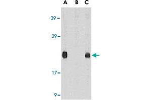 Western blot analysis of Diablo in mouse heart tissue lysate in the absence (A) or presence (B) of blocking peptide and in rat heart tissue lysate (C) with Diablo polyclonal antibody  at 1 ug /mL . (DIABLO 抗体  (AA 222-237))