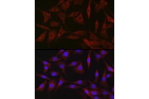 Immunofluorescence analysis of NIH-3T3 cells using BDKRB1 Rabbit pAb (ABIN7265910) at dilution of 1:250 (40x lens). (BDKRB1 抗体  (AA 1-100))