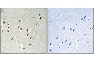 Immunohistochemistry analysis of paraffin-embedded human brain tissue, using GRF-1 (Ab-1105) Antibody. (GRLF1 抗体  (AA 1071-1120))