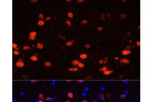 Immunofluorescence analysis of Rat brain using CALB2 Polyclonal Antibody at dilution of 1:100. (Calretinin 抗体)