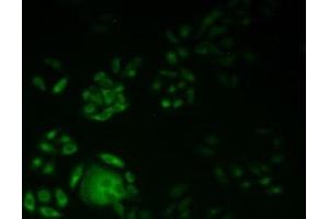 Detection of KIF18A in Human Hela Cells using Polyclonal Antibody to Kinesin Family, Member 18A (KIF18A) (KIF18A 抗体  (AA 1-453))