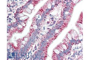 ABIN870668 (5µg/ml) staining of paraffin embedded Human Small Intestine. (ZNF652 抗体  (AA 594-606))