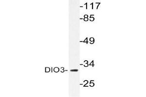 Western blot (WB) analysis of DIO3 antibody in extracts from HUVEC cells. (DIO3 抗体)