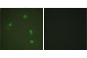 Immunofluorescence analysis of A549 cells, using Progesterone Receptor (Phospho-Ser400) Antibody. (Progesterone Receptor 抗体  (pSer400))