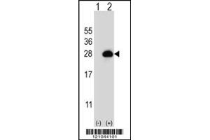 Western blot analysis of RAB3B using rabbit polyclonal RAB3B Antibody using 293 cell lysates (2 ug/lane) either nontransfected (Lane 1) or transiently transfected (Lane 2) with the RAB3B gene. (RAB3B 抗体  (C-Term))
