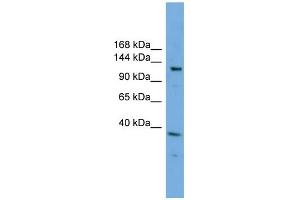 WB Suggested Anti-EIF4ENIF1  Antibody Titration: 0. (EIF4ENIF1 抗体  (N-Term))