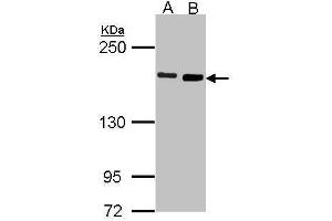 DIAPH1 抗体  (N-Term)