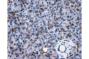 Immunohistochemical staining of paraffin-embedded liver tissue using anti-AKR1A1 mouse monoclonal antibody. (AKR1A1 抗体)