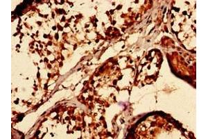 Immunocytochemistry analysis of human testis tissue using ABIN7171476 at dilution of 1:100 (TAZ 抗体  (AA 95-262))