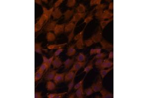 Immunofluorescence analysis of C6 cells using Legumain (Legumain (LGMN)) Polyclonal Antibody (ABIN6128201, ABIN6143172, ABIN6143173 and ABIN6214867) at dilution of 1:100 (40x lens). (LGMN 抗体  (AA 18-323))