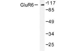 Image no. 1 for anti-Glutamate Receptor, Ionotropic, Kainate 2 (GRIK2) antibody (ABIN265439) (GRIK2 抗体)