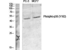 Western Blotting (WB) image for anti-Mitogen-Activated Protein Kinase 14 (MAPK14) (pTyr182) antibody (ABIN3182102) (MAPK14 抗体  (pTyr182))