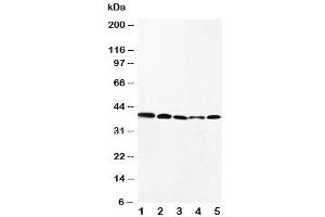 Western blot testing of CCR10 antibody and Lane 1:  HeLa (CCR10 抗体  (AA 312-327))