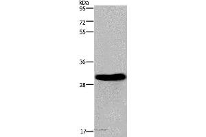 Western blot analysis of Mouse heart tissue, using FHL2 Polyclonal Antibody at dilution of 1:2400 (FHL2 抗体)
