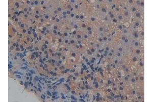 Detection of ICAM2 in Rat Adrenal gland Tissue using Polyclonal Antibody to Intercellular Adhesion Molecule 2 (ICAM2)